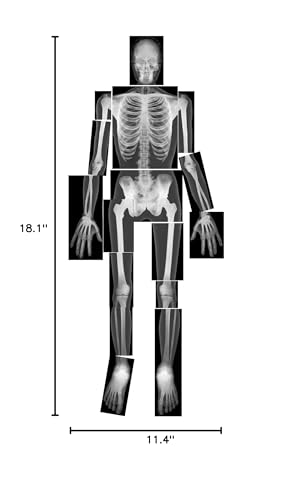 Roylco True to Life Human X-Rays, Multi-Color, 10 x 8 Size, Model R-5911, Educational Material