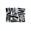 Broken Bones X-rays Set (Box of 15)