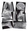 Roylco Broken Bones X-Rays – 15 Realistic Fracture Images For Stem/Steam Learning, Classroom Anatomy, Health Education, And Labs – Perfect For Teachers, Parents, And Medical Training