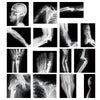 Sayglossy 15 Pcs Broken Bones X Ray Set Human X Rays Black And White Skeleton Pretend Xrays For Kids