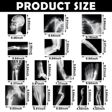 Sayglossy 15 Pcs Broken Bones X Ray Set Human X Rays Black And White Skeleton Pretend Xrays For Kids