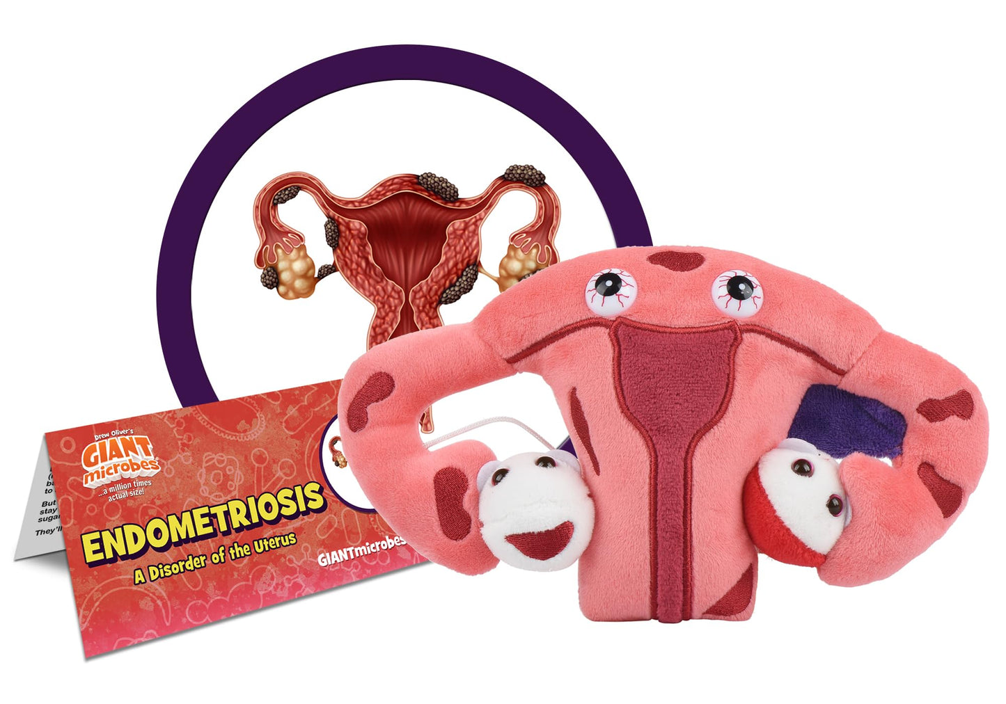 Giantmicrobes Endometriosis Plush- Learn About Health, Fertility And This Chronic Inflammatory Disease, Get Well Gift For Post-S