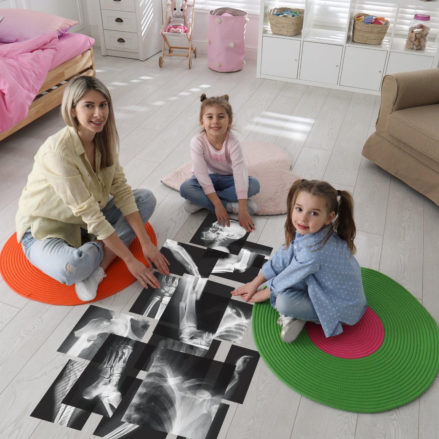 Sayglossy 15 Pcs Broken Bones X Ray Set Human X Rays Black And White Skeleton Pretend Xrays For Kids