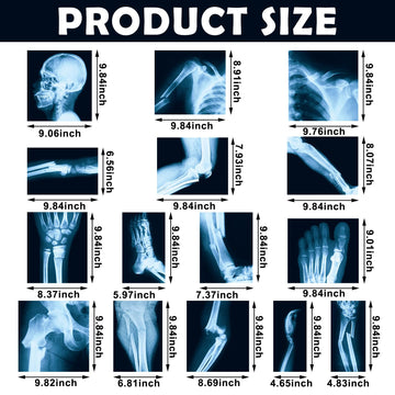 Sayglossy 15 Pcs Broken Bones x Ray Set Human x Rays Black and Blue Skeleton Pretend Xrays for Kids