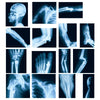 Sayglossy 15 Pcs Broken Bones x Ray Set Human x Rays Black and Blue Skeleton Pretend Xrays for Kids