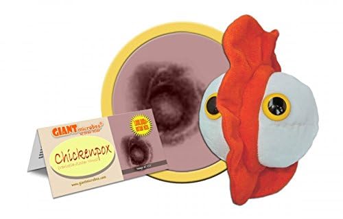 GIANTMICROBES Chickenpox Plush Toy – Educational 8" Soft Toy for Pediatricians & Science Lovers, Plush Material