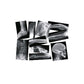 Broken Bones X-rays Set (Box of 15)