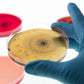 Onnetila Bacteria Science Kit Petri Dishes With Agar Educational Stem Science Fair Project Kit For Kids Age 9 And Above