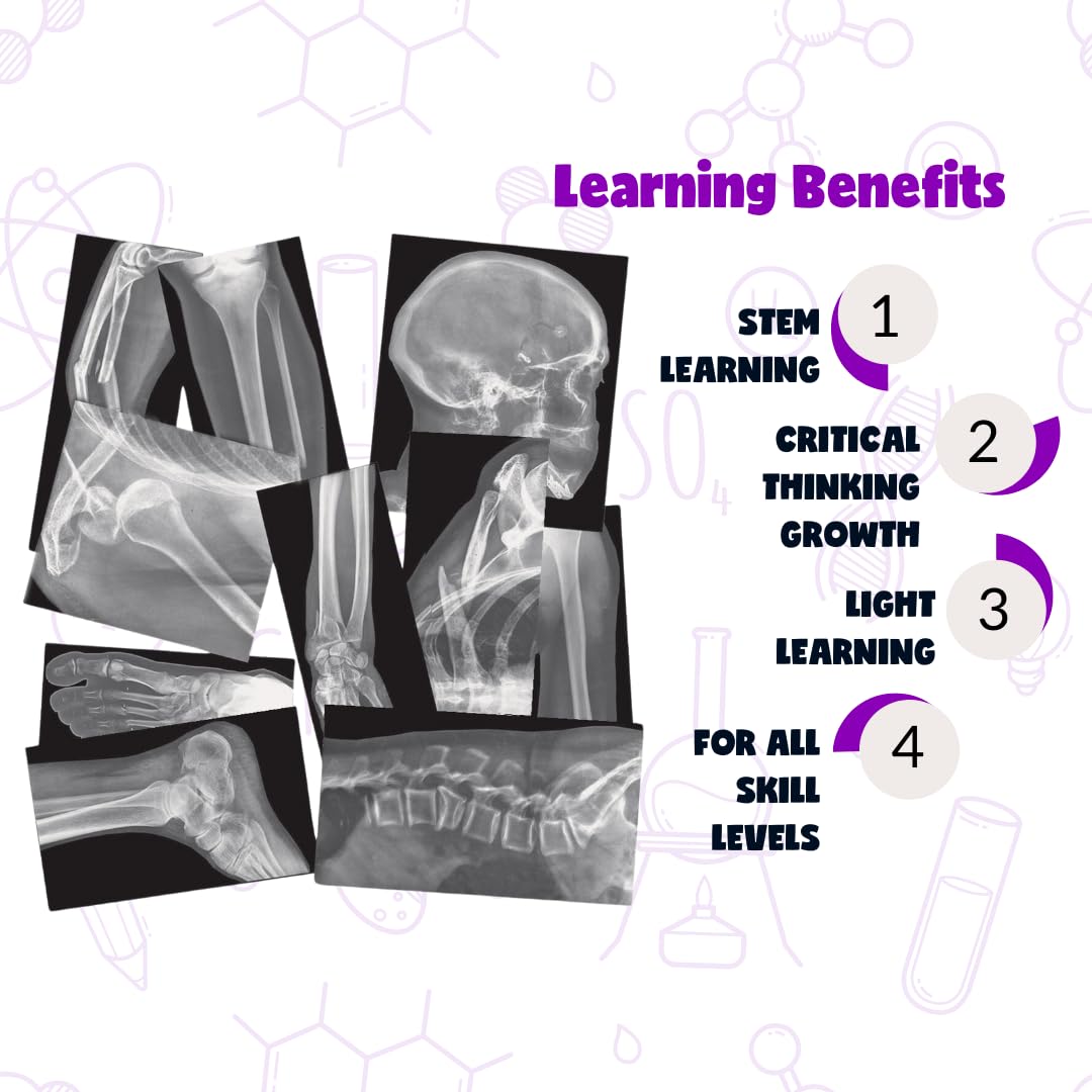 Roylco Broken Bones X-Rays – 15 Realistic Fracture Images For Stem/Steam Learning, Classroom Anatomy, Health Education, And Labs – Perfect For Teachers, Parents, And Medical Training