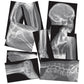 Roylco Broken Bones X-Rays – 15 Realistic Fracture Images For Stem/Steam Learning, Classroom Anatomy, Health Education, And Labs – Perfect For Teachers, Parents, And Medical Training