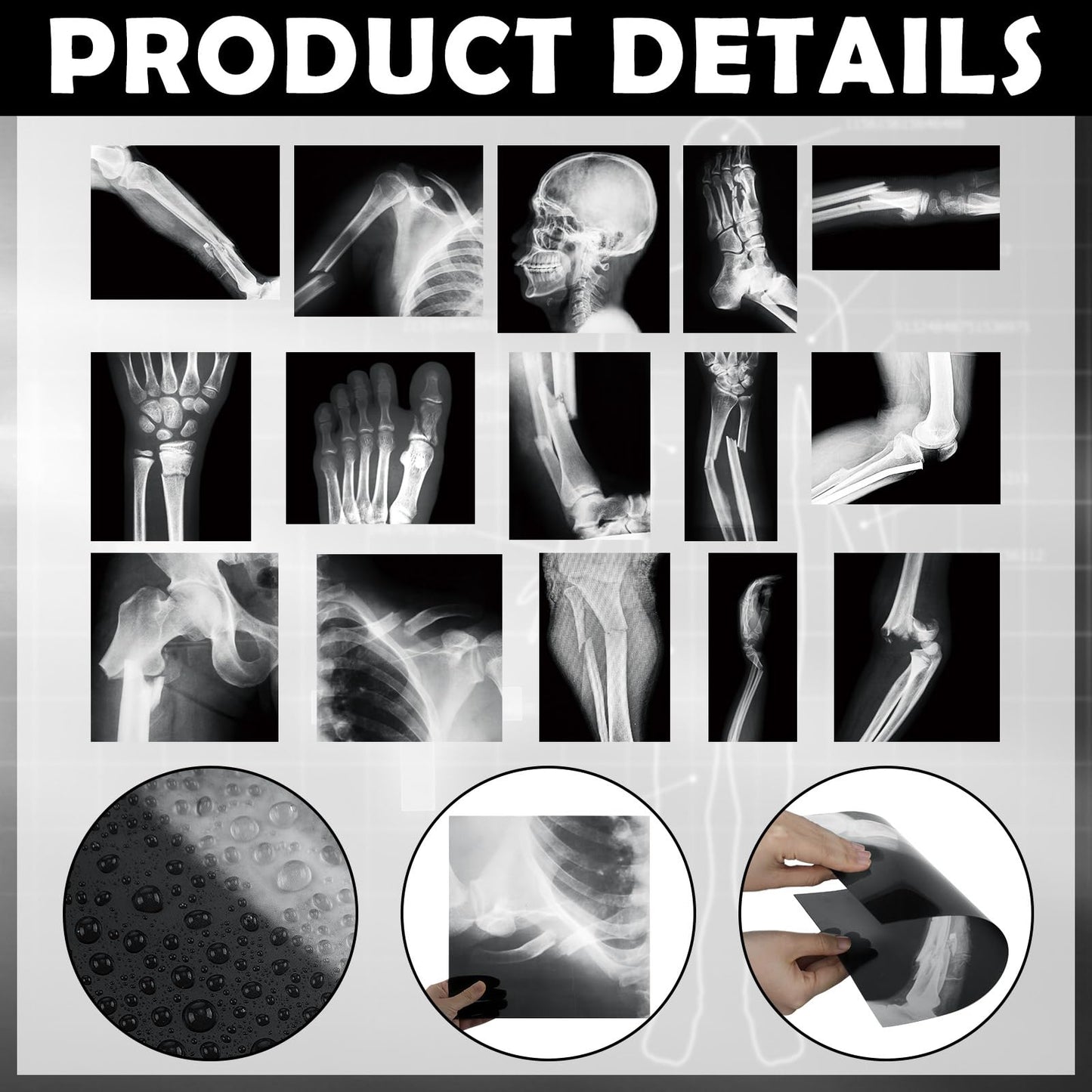 Sayglossy 15 Pcs Broken Bones X Ray Set Human X Rays Black And White Skeleton Pretend Xrays For Kids