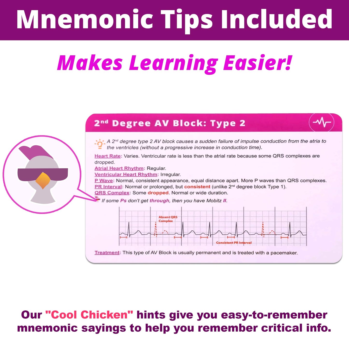 Ekg Interpretation Flash Cards - For Nursing/Emt/Paramedic School - 2025 Nclex Ati Hesi Review Lpn Rn Flash Cards (45 Cards)