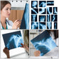 Sayglossy 15 Pcs Broken Bones x Ray Set Human x Rays Black and Blue Skeleton Pretend Xrays for Kids