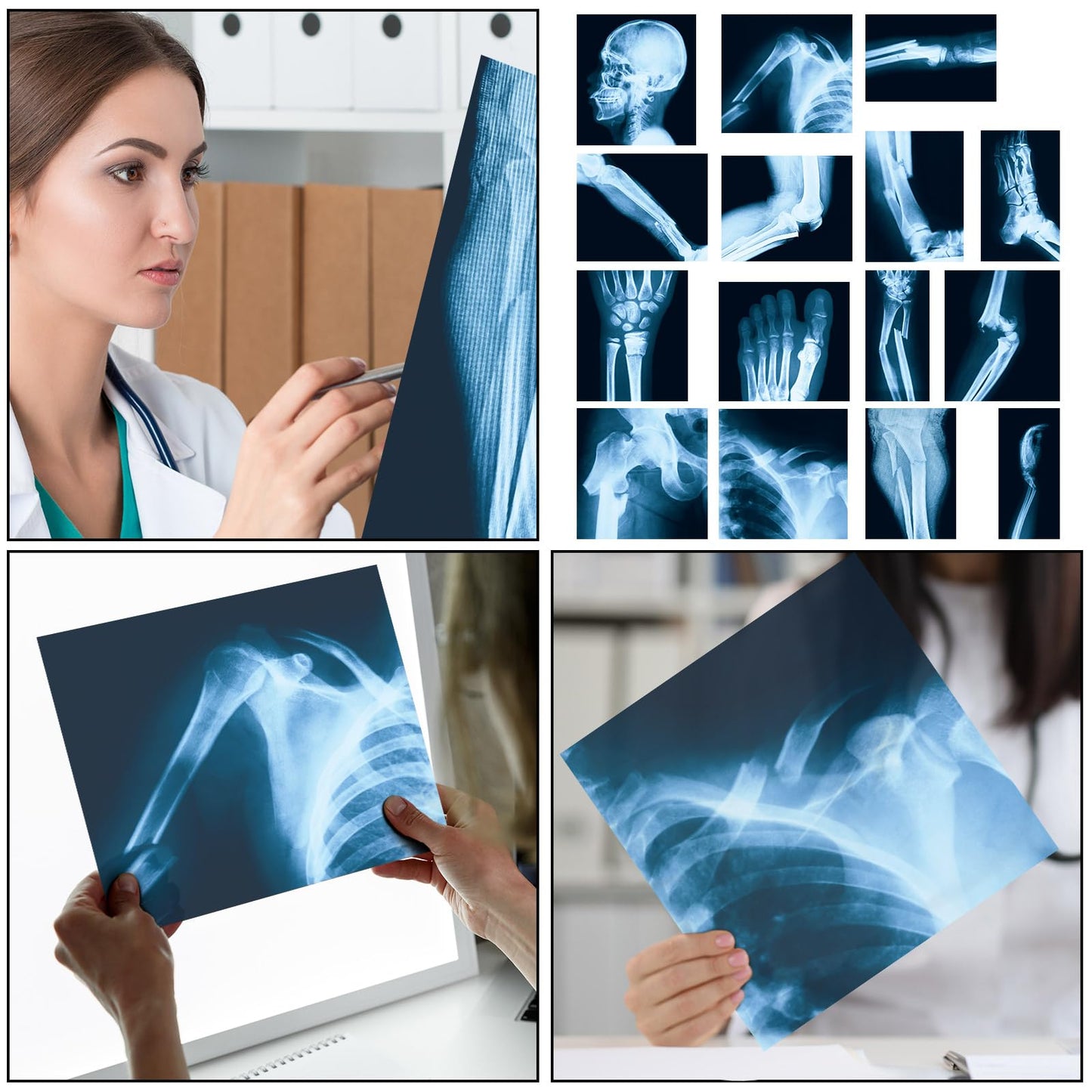 Sayglossy 15 Pcs Broken Bones x Ray Set Human x Rays Black and Blue Skeleton Pretend Xrays for Kids
