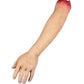 Severed Arm
