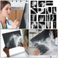 Sayglossy 15 Pcs Broken Bones X Ray Set Human X Rays Black And White Skeleton Pretend Xrays For Kids