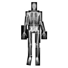 Roylco True To Life Human Xrays