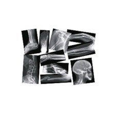 Broken Bones Xrays Set Box Of 15